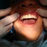 Aesthetic Dentistry2