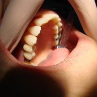 Aesthetic Dentistry3