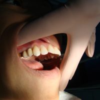 Aesthetic Dentistry4