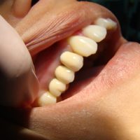 Aesthetic Dentistry5