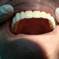 Aesthetic Dentistry6