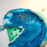 Implants34