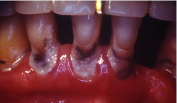 pediodontics2