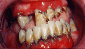 pediodontics3