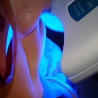 teeth whitening4